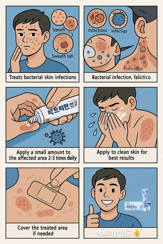 박트리안 연고(에스로반연고)