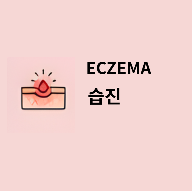 습진(Eczema)