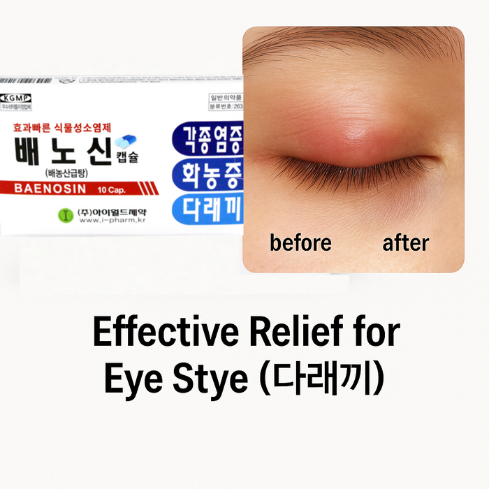 배노신캡슐(배농산급탕)Eye inflammation